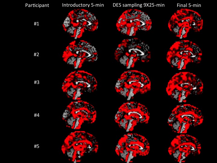 Neuroimaging scans of the brain from a study using Descriptive Experience Sampling