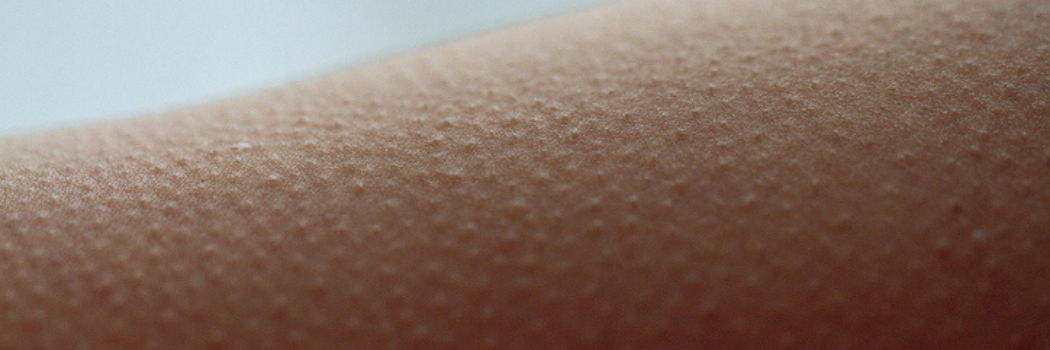 Goosebumps on an arm