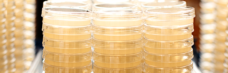 Rows of stacked of agar plates