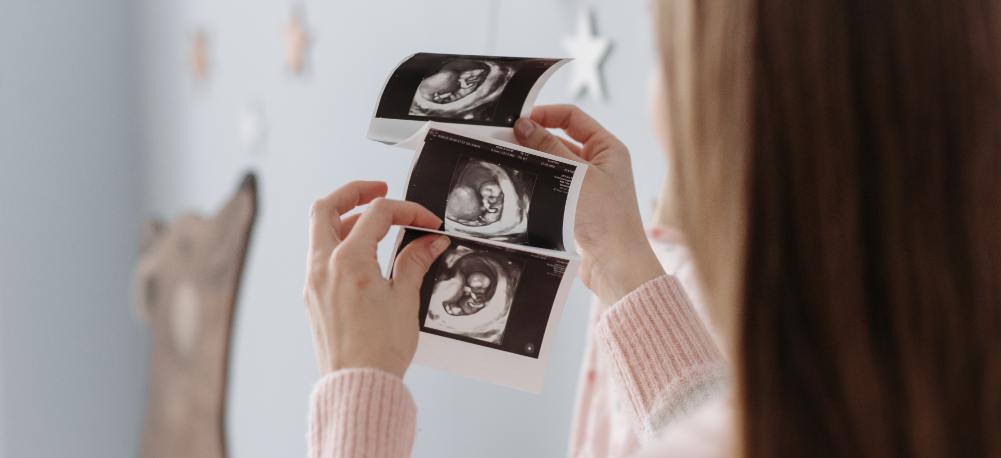 Person holding foetus scan