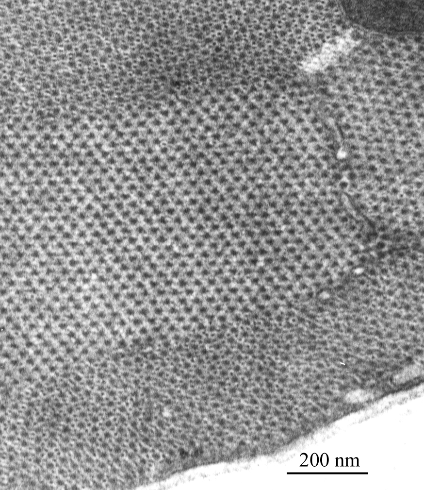 TElectron micrograph image showing part of a skeletal muscle fibre, sectioned transversely across the length of the fibre, courtesy of Dr R W Banks